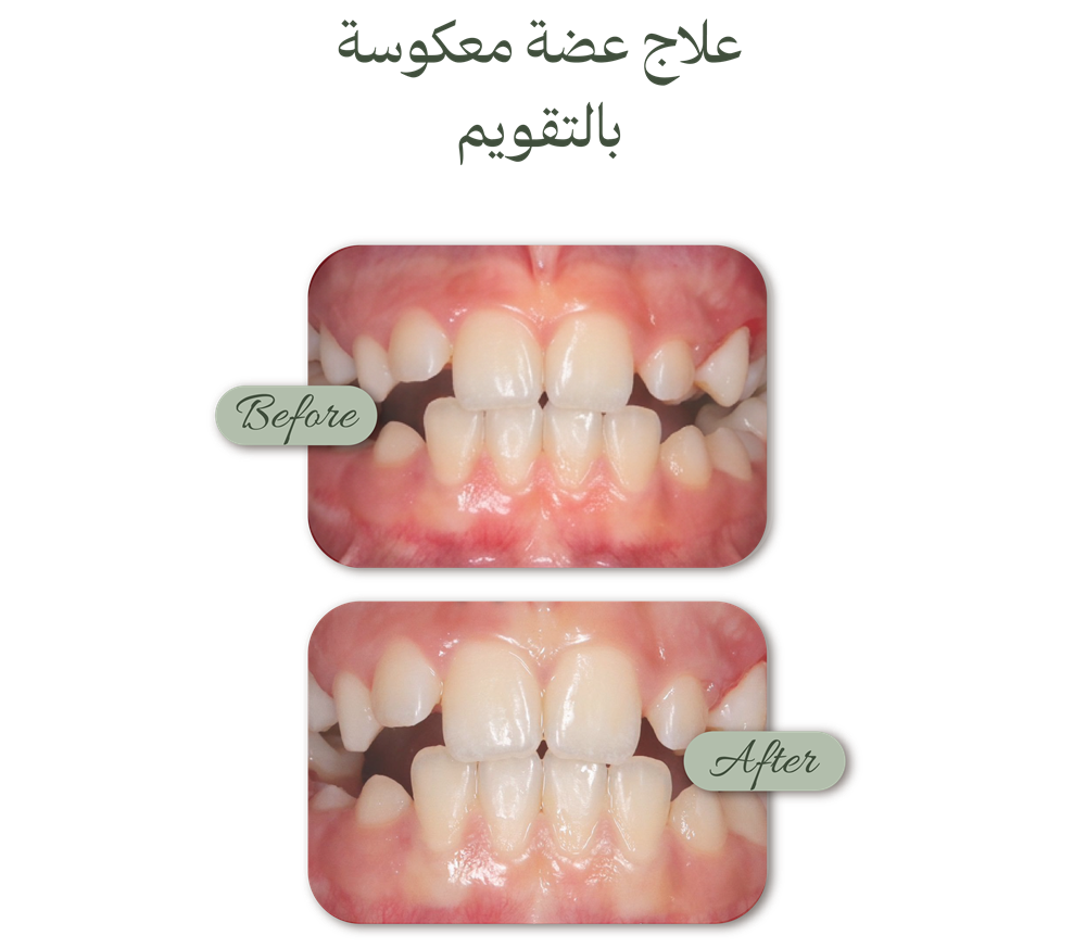 الصفحة الرئيسية حالات قبل وبعد (1)