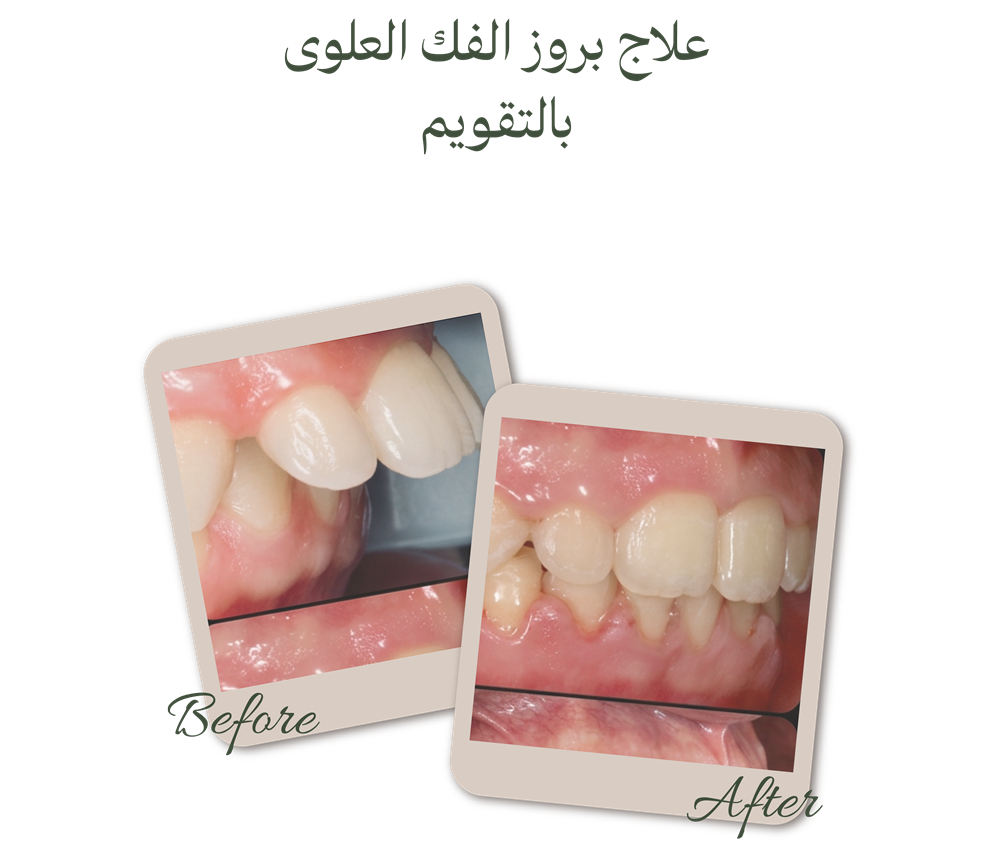 الصفحة الرئيسية حالات قبل وبعد (2)
