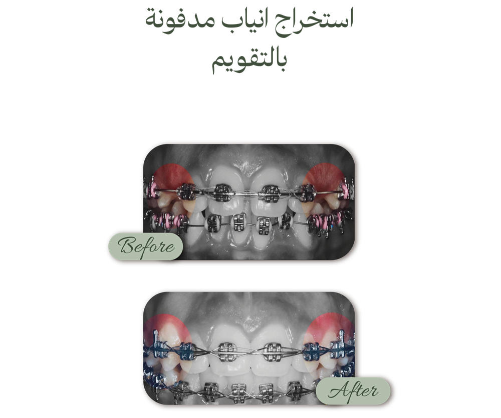 الصفحة الرئيسية حالات قبل وبعد (4)