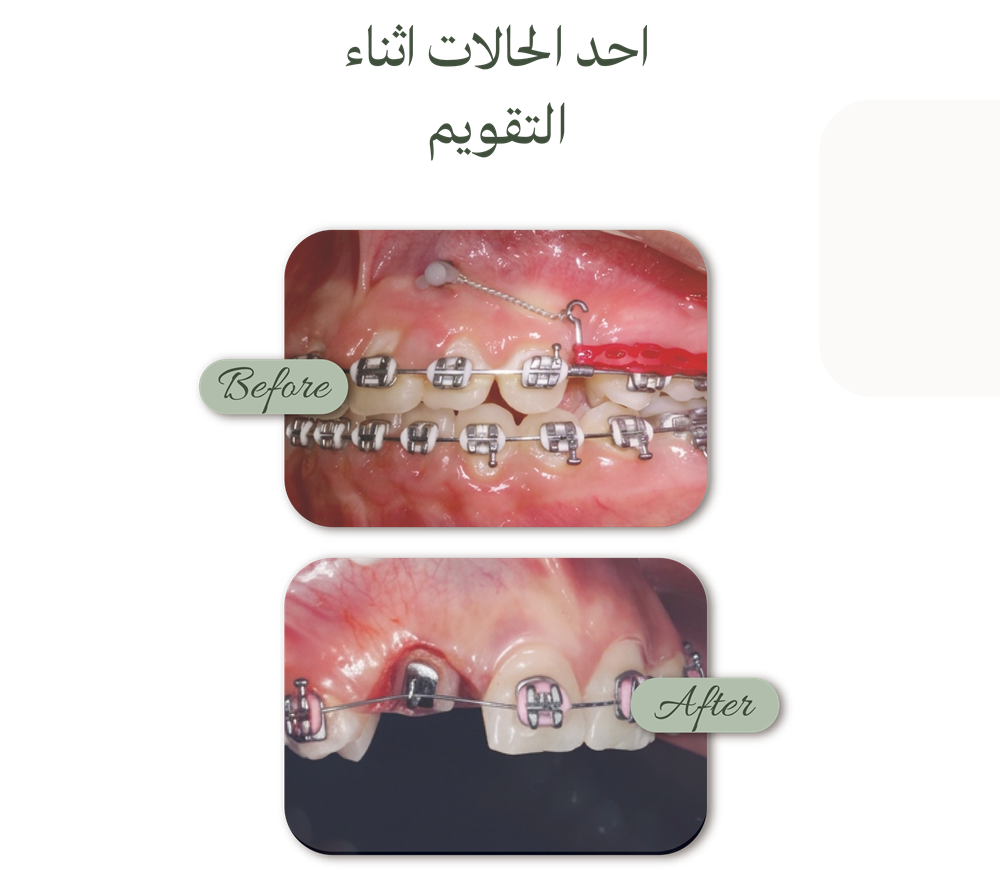 الصفحة الرئيسية حالات قبل وبعد (5)