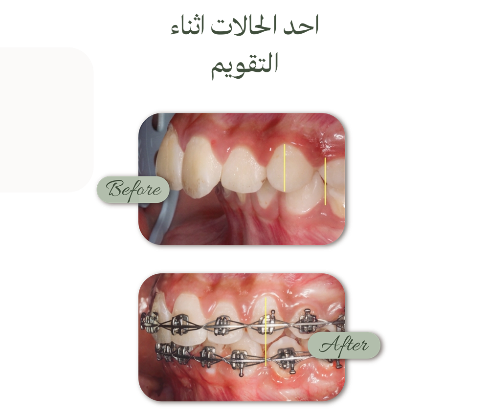 الصفحة الرئيسية حالات قبل وبعد (6)