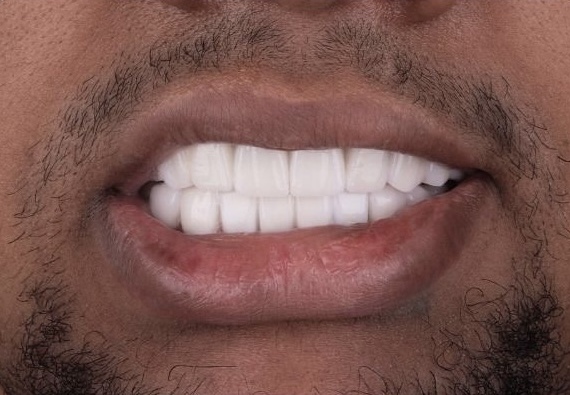 4 1